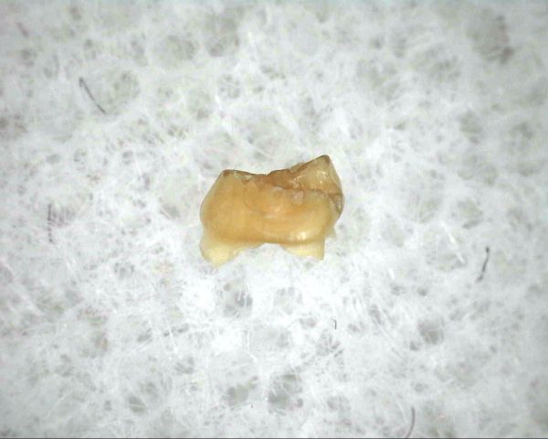 Proscalops Insectivore Tooth #1 - Image 2