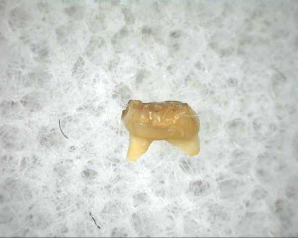 Proscalops Insectivore Tooth #1 - Image 3