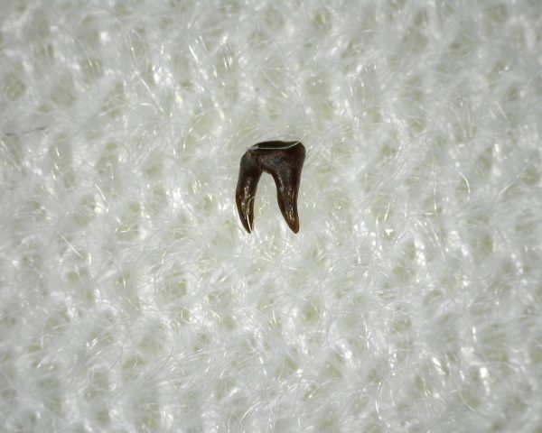 Xenacanthus Permian Shark Tooth #5 - Image 3