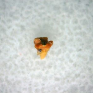 Heterodontus Extinct Shark Tooth Fossil for Sale 26
